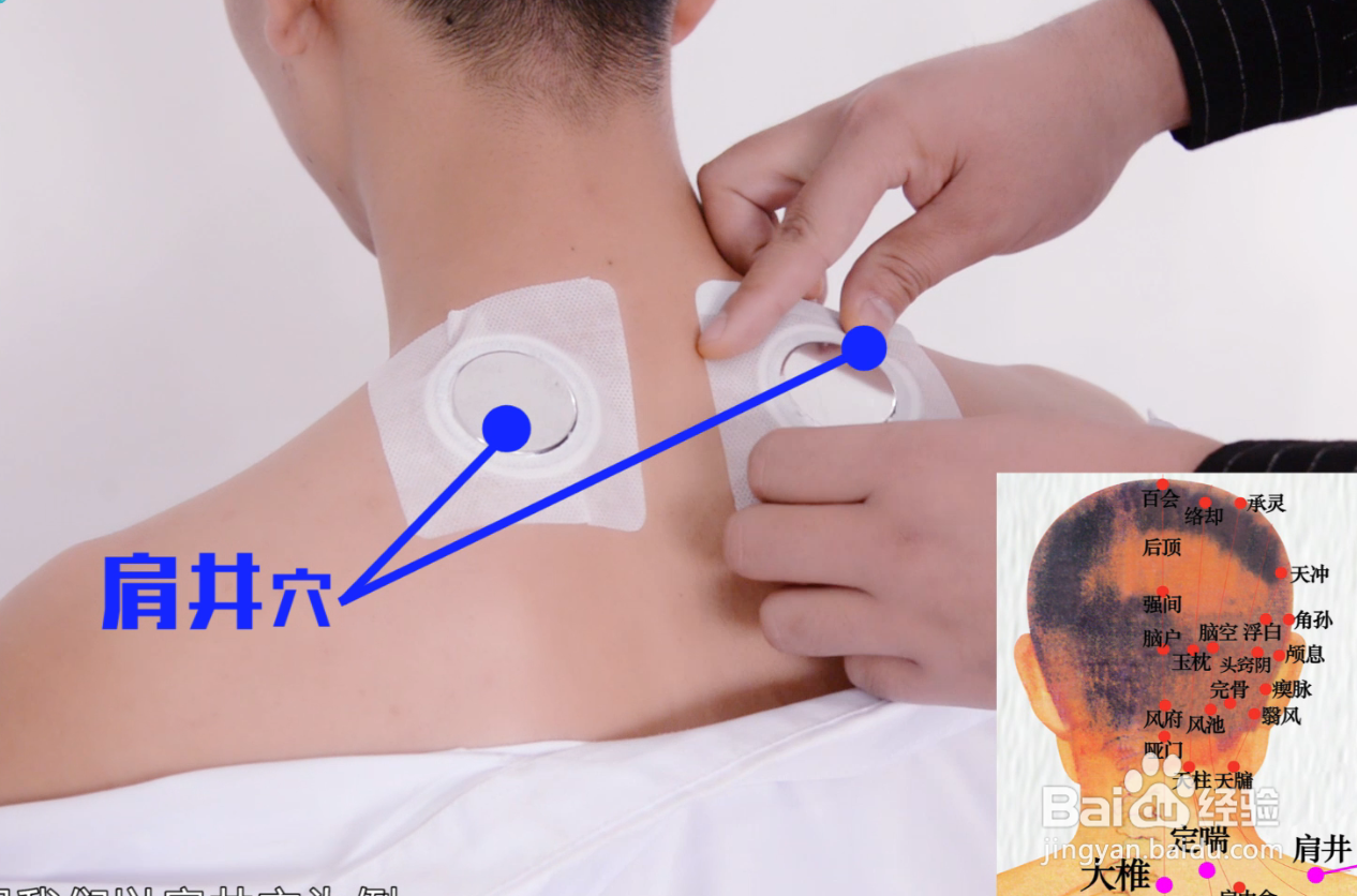 中医定向透药治疗仪的操作方法详细介绍