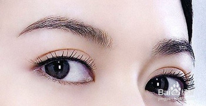 单眼皮怎么变成双眼皮?