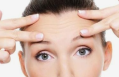 祛鱼尾纹的方法