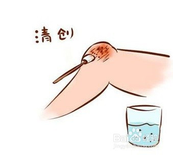 骑车摔了擦破皮怎么办