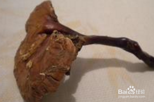 怎么预防感冒？如果发烧怎么办？