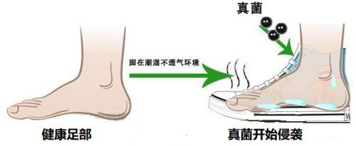 引起脚裂口的六种原因 百度经验 引起脚裂口的六种原因 百度经验