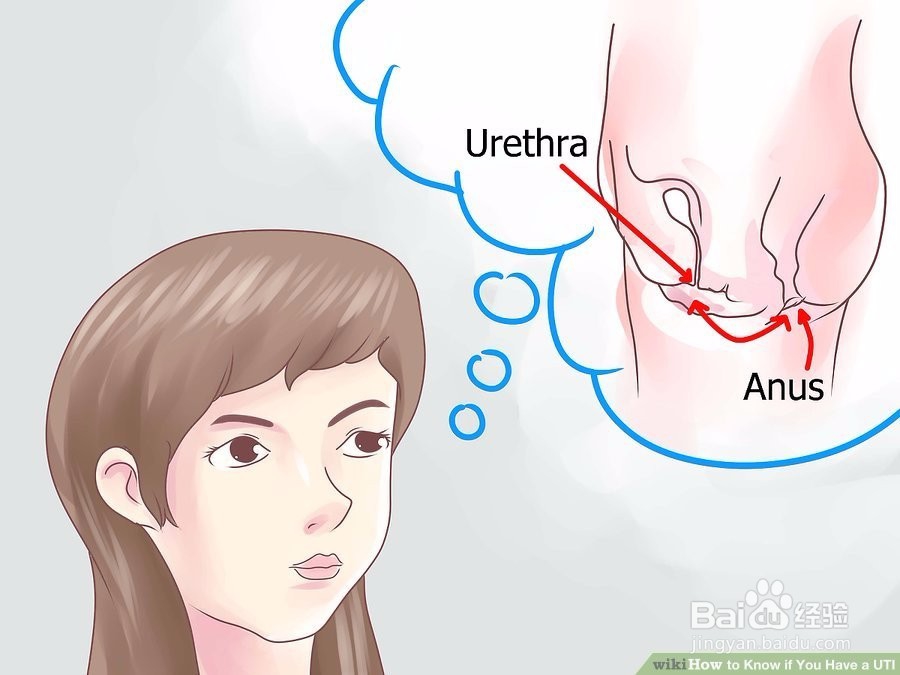 如何知道你是否有UTI