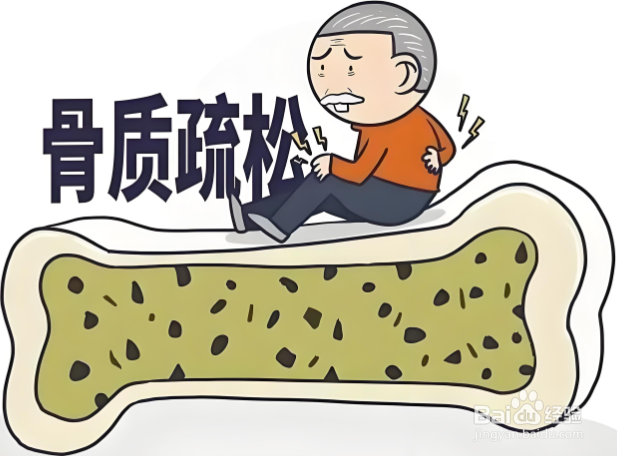 骨质疏松的风险因素与骨密度检查建议