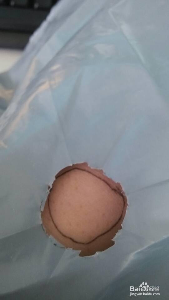 紫外线光疗仪：[5]遮挡篇