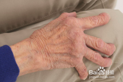 腰肌劳损的治疗有妙招，你掌握没？