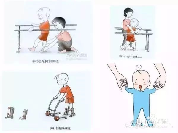 脑瘫康复训练图文版，从抬头训练到行走训练教程