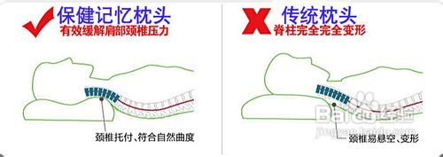 颈椎保健枕如何选择？