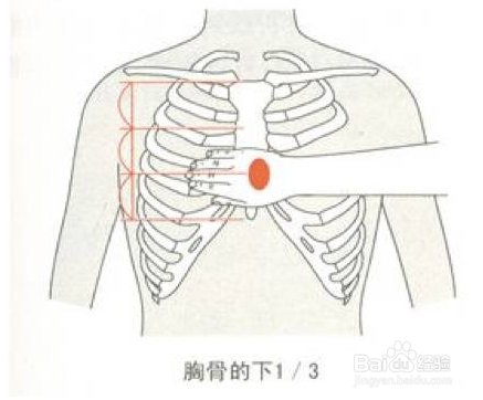 在胸骨下端1/3处,即胸廓正中线与左侧乳头之间疼痛