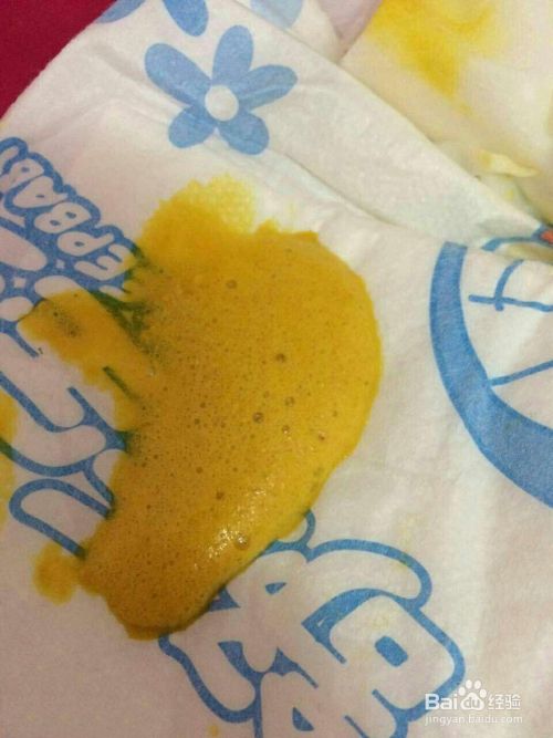 刚出生的婴儿总是拉泡沫便便怎么办