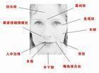 面瘫后遗症的表现具体是如何的