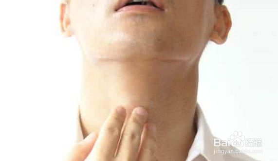 什么是慢性咽炎，慢性咽炎的治疗方法