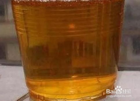 这几个特征说明你体内湿热较重