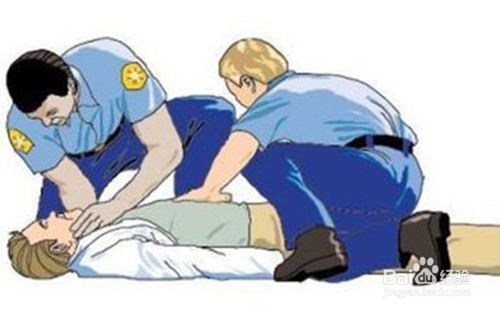 脑血管意外有哪些特征?