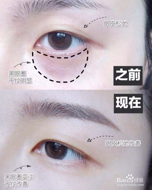 正确涂眼霜按摩方法