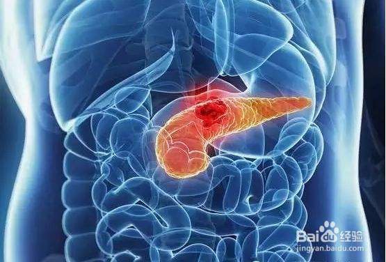 这样拉肚子可能是4种癌症的信号