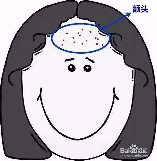 长痘痘该怎么解决？