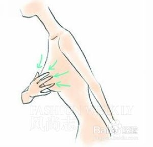 丰胸胸线提升法