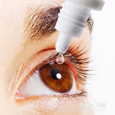 烧电焊眼睛疼怎么办