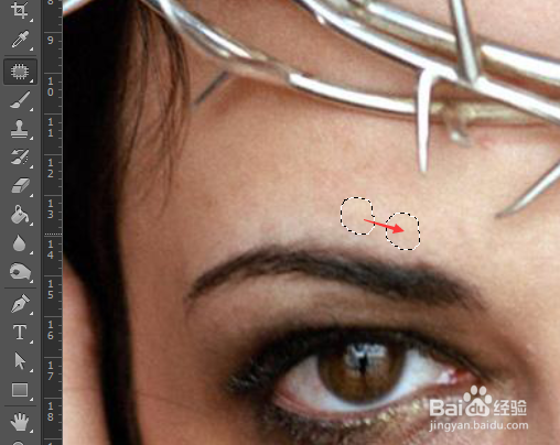 怎么简单地用PS祛斑祛痘