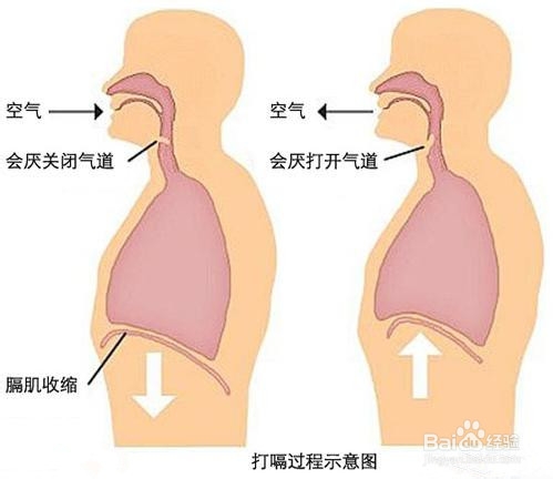 长时间打嗝是怎么回事