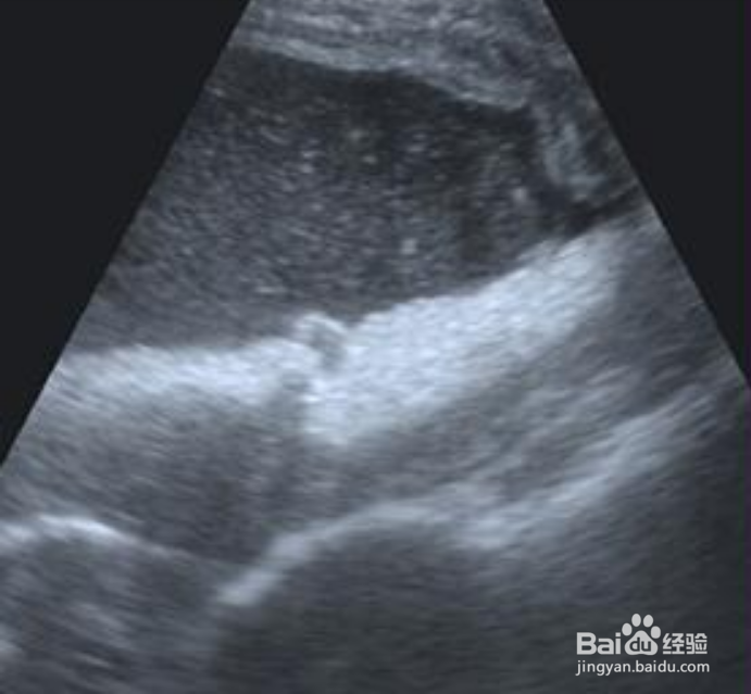 经常不吃早餐的坏处和危害