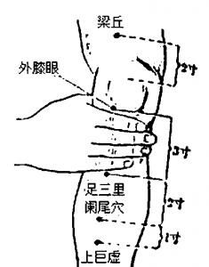 经常痛经怎么办？艾灸几次吧！