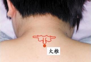 颈椎病的预防和调理