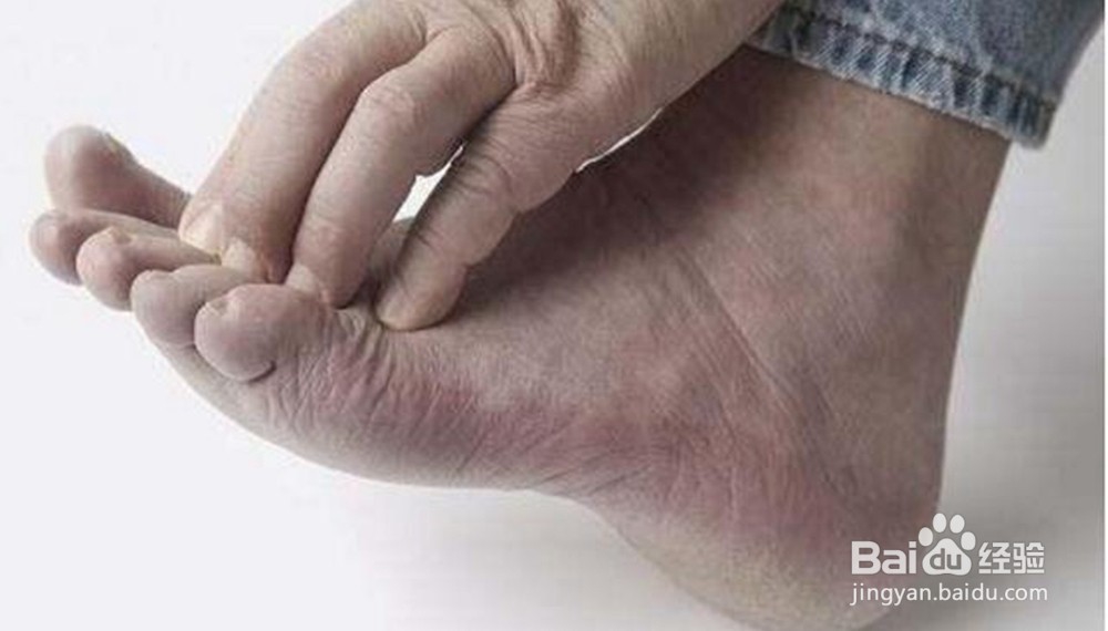 白背三七诺丽果提醒你,高血糖也有症状,要警惕