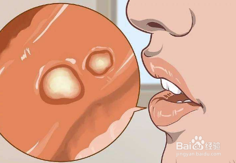 什么样体质的人要少吃辣椒