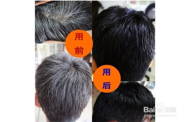怎样做才能开一家中药养发店