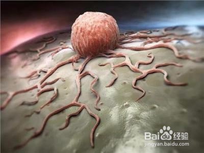 食道癌偏爱哪些人？