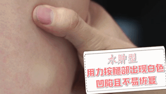 怎样才能快速瘦腿