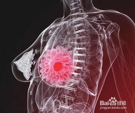 肺癌是我国死亡率最大的恶性肿瘤，癌症仍然是人类的大敌