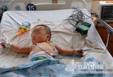 新生儿死亡怎么办