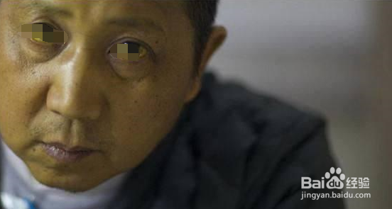 人不睡觉会怎么样