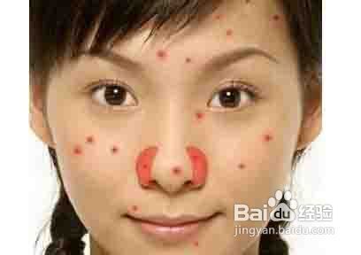 痘痘背后黑手！揭秘：怎样正确洗脸