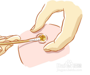 护理新生宝宝脐带需要注意什么