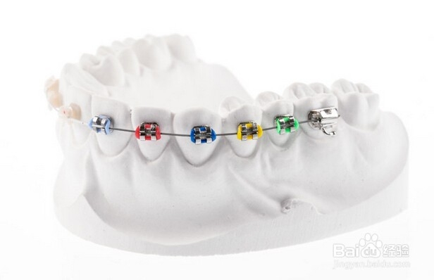 成人龅牙矫正有风险吗?