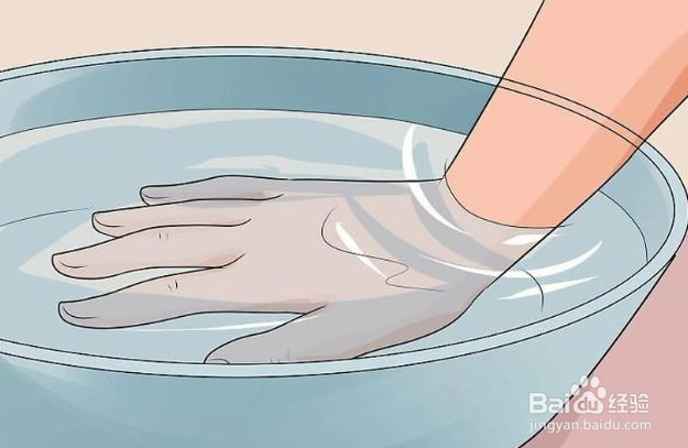 烫伤我们该如何处理?