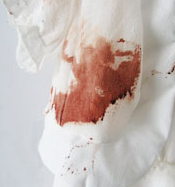 如何去除衣服上的另类污渍