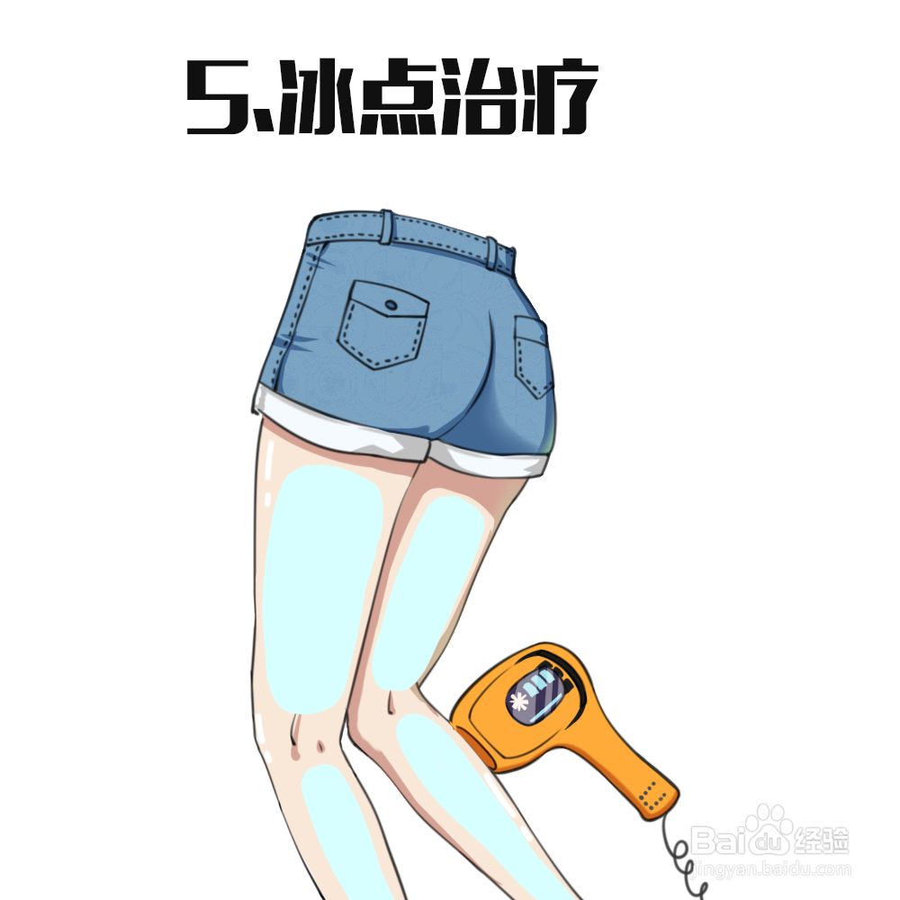 冰点脱毛流程图片