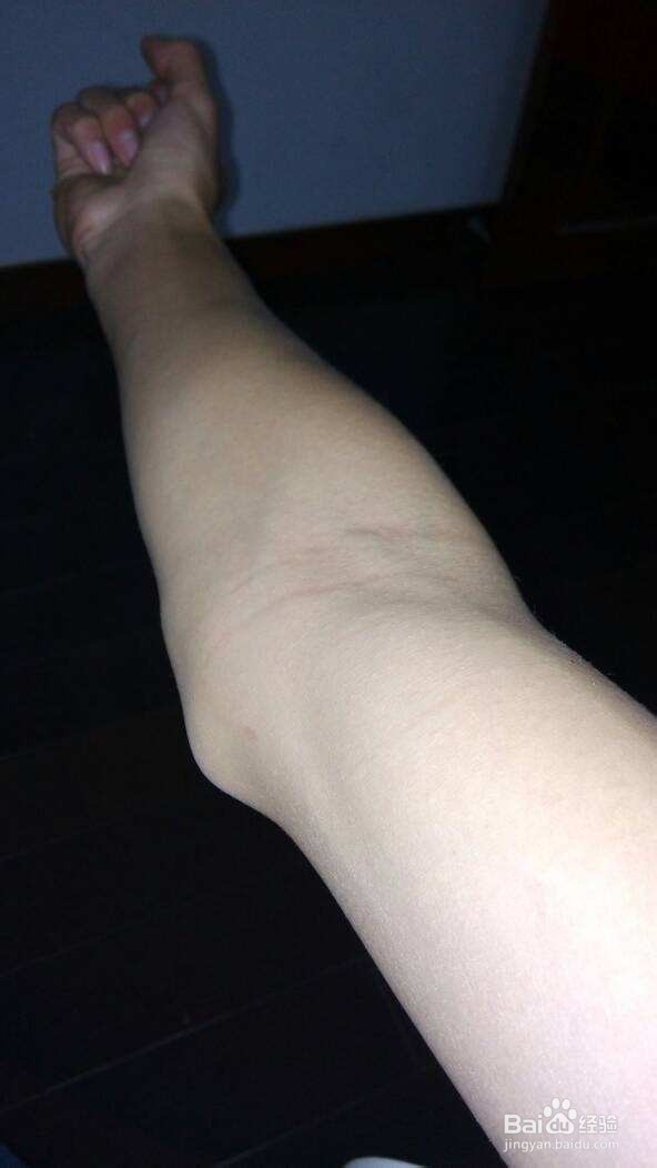 锻炼手部肌肉要注意什么