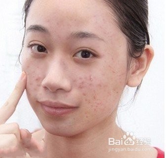 你知道有些药膏是不能乱用的吗