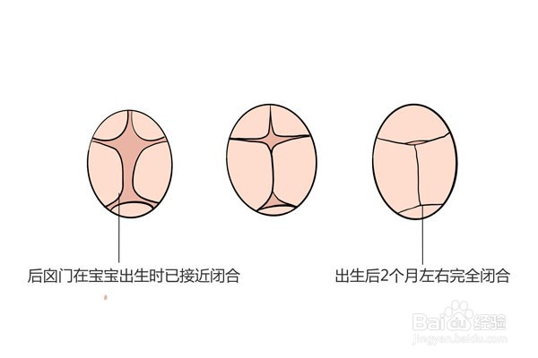 如何保护婴儿囟门