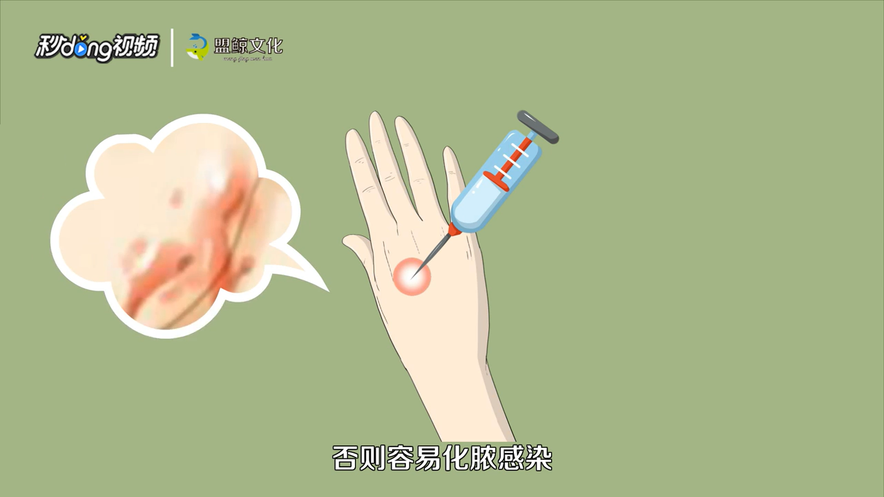 烫伤怎么处理