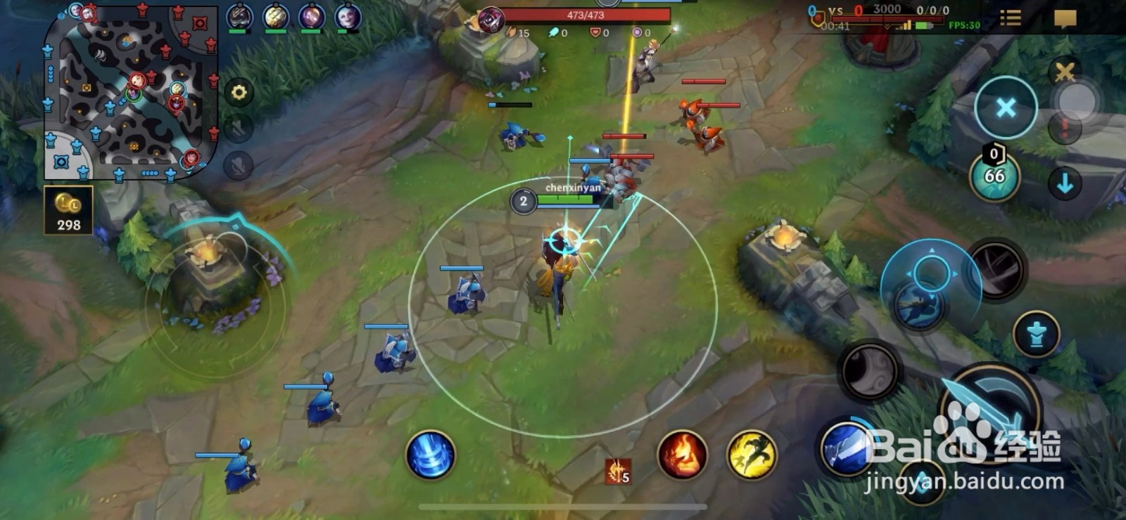 英雄联盟手游亚索怎么玩