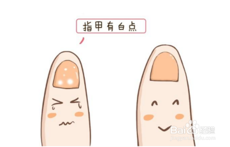 宝宝指甲上有白点，是缺微量元素，还是得了什么疾病？其实都错了