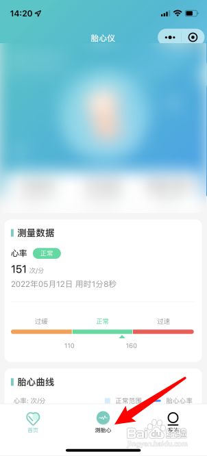 海尔胎心仪怎么连接手机