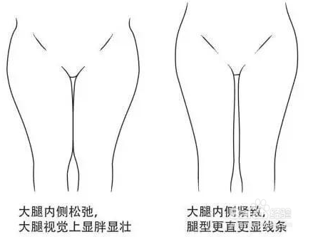 不同的腿型,不同的锻炼方法,看看那个适合您!